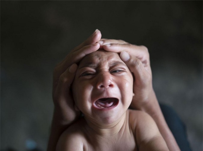 Virus Zika có thể lây qua đường tình dục, muỗi đốt