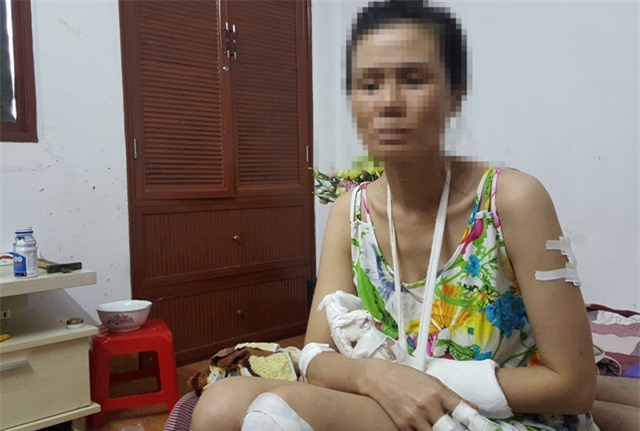 “Ngáo đá” lên cơn chém gần đứt bàn tay chủ nhà