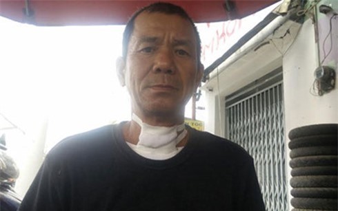 Côn đồ táo tợn cắt cổ tài xế xe ôm, cướp giữa ban ngày