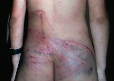 Thanh Hoá: Bố tàn độc dùng dây điện đánh con tím người