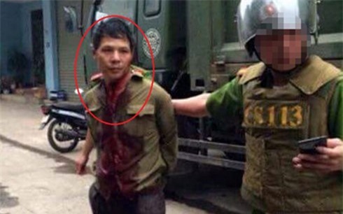 Đưa kẻ máu lạnh chém đứt lìa tay chị gái đi giám định tâm thần 