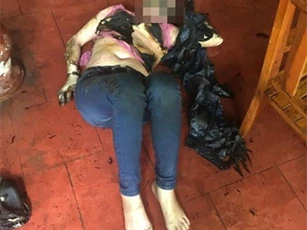 Kẻ tẩm xăng đốt một phụ nữ tại quán cà phê đã ra tự thú