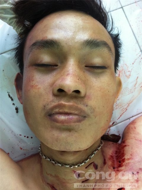 Tìm thân nhân nam thanh niên bị giết dã man trong lô cao su