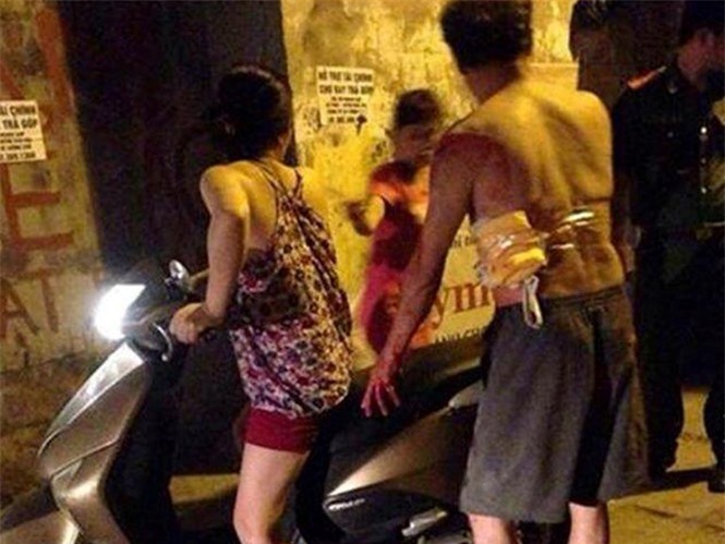 Hà Nội: "Nhạc phụ" phát hoảng vì con rể cầm dao mổ lợn tấn công