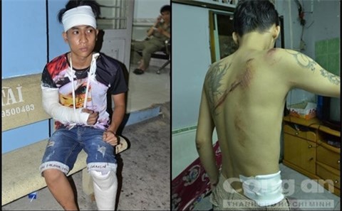 Khởi tố nhóm giang hồ xách mã tấu chém nhiều người ở Sài Gòn