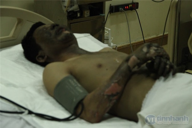 Công nhân Formosa bị bỏng nặng vì trúng tia lửa điện