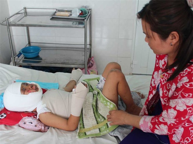 Bắt chước tục phun lửa trong đám tang, bé trai 7 tuổi nguy kịch