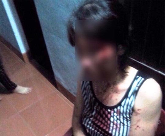 Chồng đánh vợ sẩy thai lúc nửa đêm vì... không nấu cơm