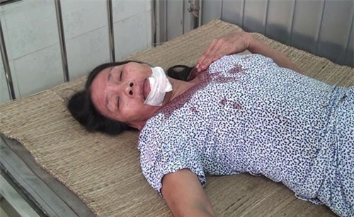 Hãi hùng lời kể nhân chứng vụ tai nạn thảm khốc ở Bình Thuận