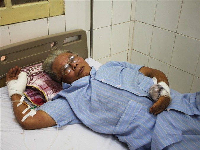 Nghệ An: Cụ ông bán tạp hóa bị côn đồ chém đứt lìa ngón tay