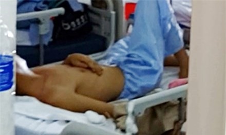 Vụ truy sát hai vợ chồng tại Nghệ An: Túc trực theo dõi hung thủ