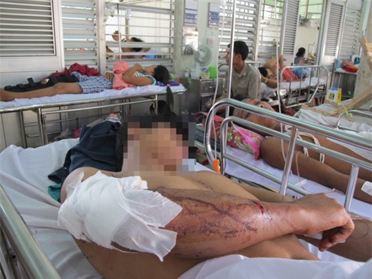 Tin mới nhất vụ giang hồ xông vào bệnh viện chém người ở Sài Gòn