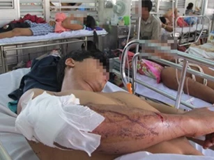 Bắt kẻ cầm đầu băng nhóm xông vào bệnh viện chém người