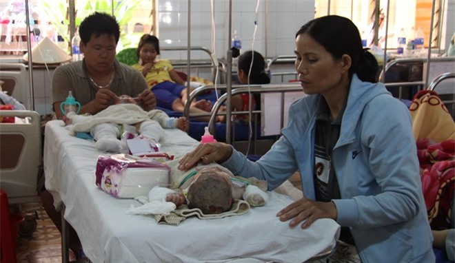 Chồng đổ xăng đốt nhà tự thiêu, 4 người nguy kịch