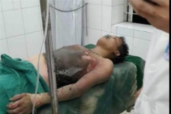 Người chồng tẩm xăng tự thiêu vì... vợ không về nhà