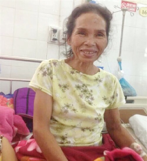 Bà lão 60 tuổi sống sót sau 10 ngày ngã xuống giếng