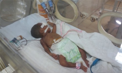 Kỷ luật bác sĩ chẩn đoán nhầm khiến bé gái suýt bị chôn sống