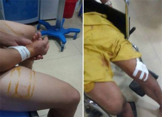 Nam thanh niên đang nhảy hát trong đám cưới thì bị chém chết