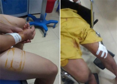 Hé lộ nguyên nhân thanh niên bị chém chết trong đám cưới