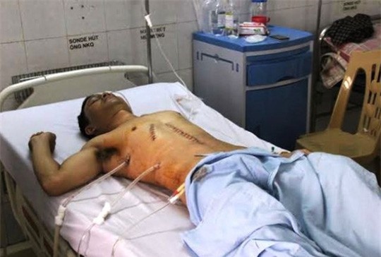 Bắt giam kẻ đâm trọng thương Phó công an xã ở Thanh Hóa