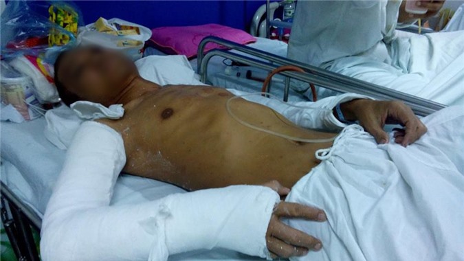 Ngồi uống nước vỉa hè, thanh niên bị côn đồ đánh trọng thương