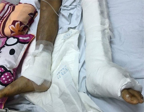 Bộ Y tế yêu cầu xử lý nghiêm vụ "đau chân trái, mổ chân phải"