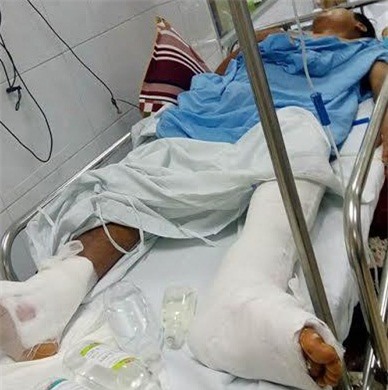 Vụ mổ nhầm chân ở BV Việt Đức: Gia đình bệnh nhân nói gì?