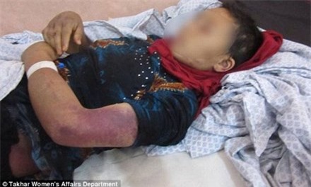 Vợ bị cả nhà chồng đánh đập, cắt bộ phận sinh dục dù đang mang thai