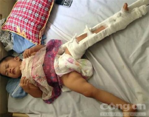 Tai nạn nghiêm trọng, vợ chồng tử vong để con nhỏ bơ vơ