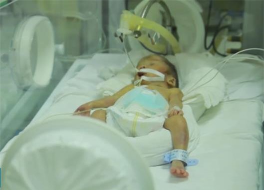 Tin mới về sức khỏe em bé được mẹ nhường lại sự sống