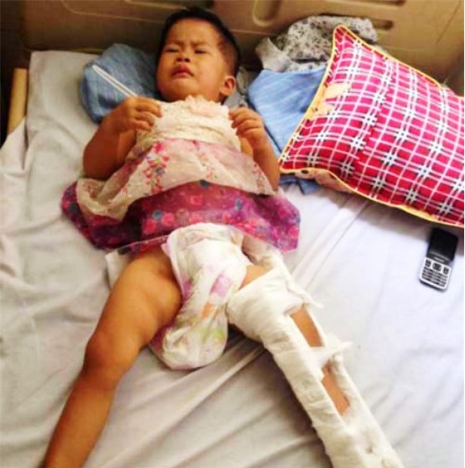 Cha mẹ tử vong, con thơ bị gãy chân sau tai nạn kinh hoàng