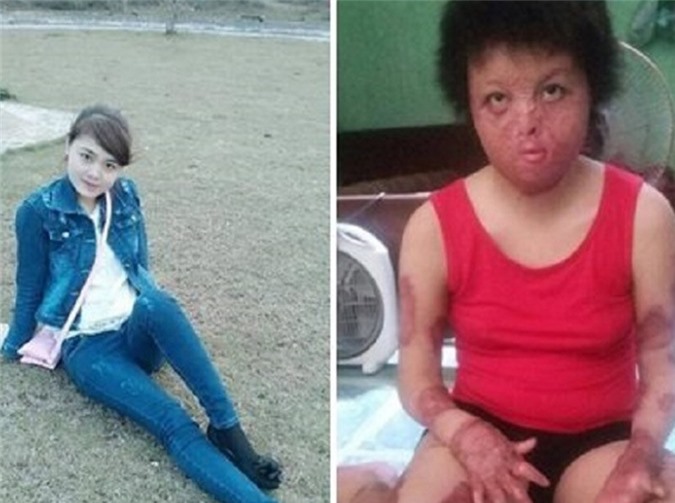 Bắt gã chồng tàn bạo tẩm xăng thiêu sống vợ đẹp