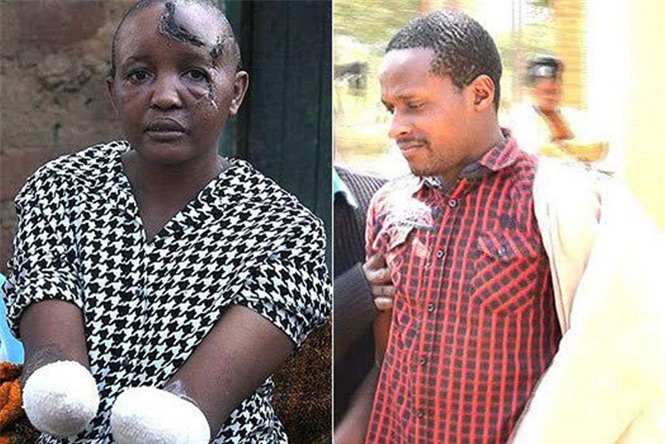 Kinh hoàng chồng tàn độc chặt đứt tay vợ vì "không chịu mang bầu"