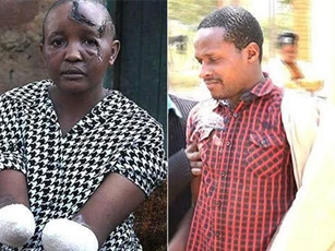 Kinh hoàng chồng tàn độc chặt đứt tay vợ vì "không chịu mang bầu"