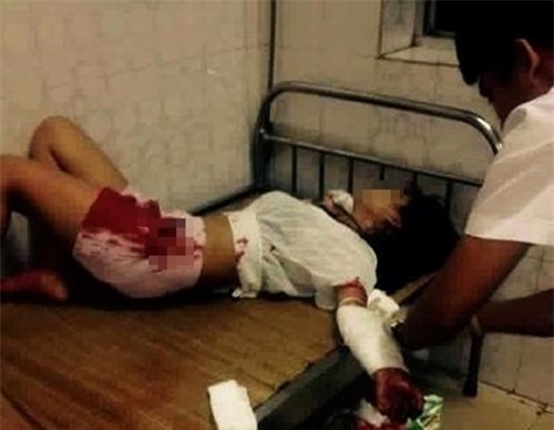 Cô gái rạch tay tự sát trong cuộc cãi vã với người yêu ở nhà nghỉ