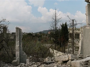 Một phụ nữ ở Syria bị mảnh đạn pháo cắt đứt chân tay vì bảo vệ con