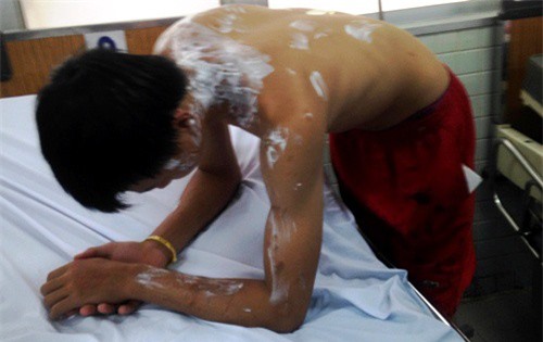 Vỡ thùng axit chợ Kim Biên ở Sài Gòn, 5 người bị thương