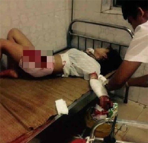 Ghen tuông, thiếu nữ 16 tuổi rạch tay tự tử trước mặt người yêu