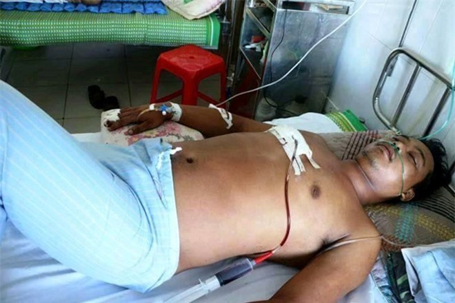 Tài xế taxi bị truy sát ở Nghệ An: Tình tiết mới nhất