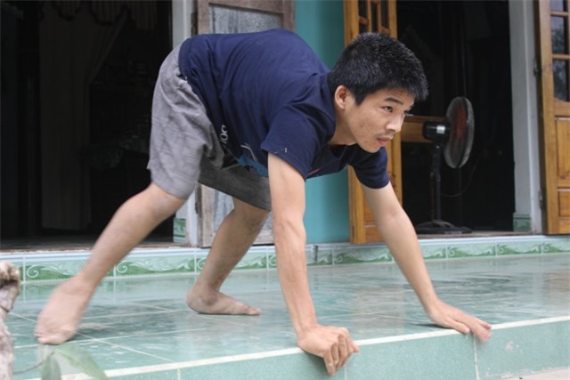 Nỗi đau da cam : quặn thắt khó nói thành lời !