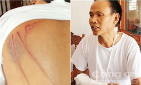 Con bất hiếu đuổi mẹ ra khỏi nhà, chém công an can thiệp