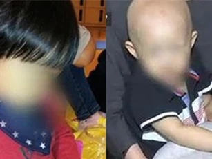 Uống "thảo dược" 1 tuần bé 2 tuổi không còn một sợi tóc