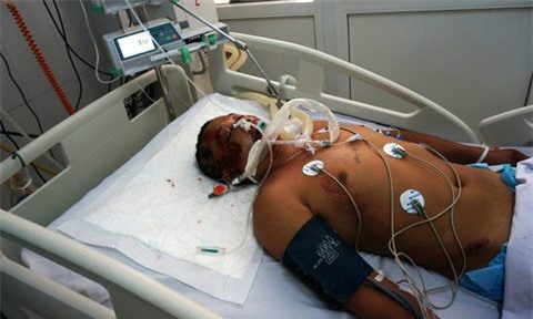 Phát hiện người đàn ông bị chém nhiều vết trên mặt, đang nguy kịch