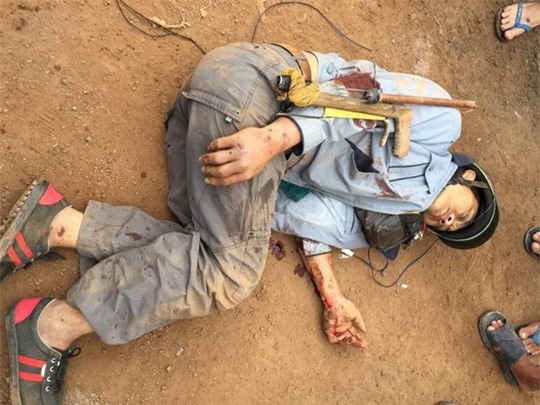 Cẩu tặc bị dân vây đánh gãy hai tay, hai chân