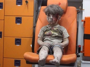 Quốc tế dậy sóng về em bé Syria bê bết máu trên mặt