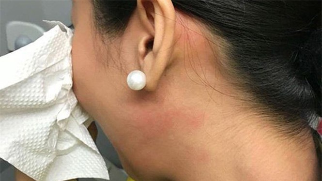 Vụ tát tiếp viên hàng không: Nạn nhân xin nghỉ 3 ngày