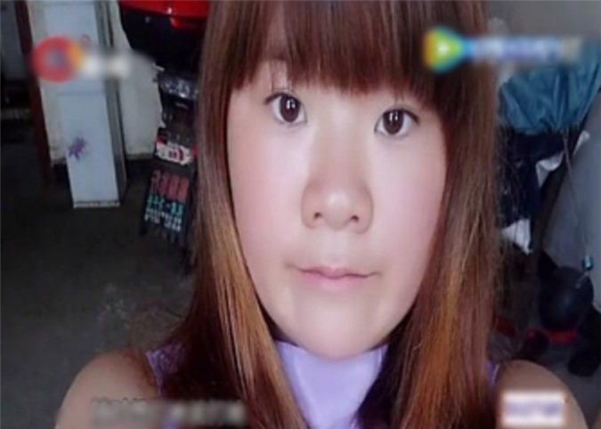 Xin ly hôn bị chồng rạch mặt cắn nát mũi