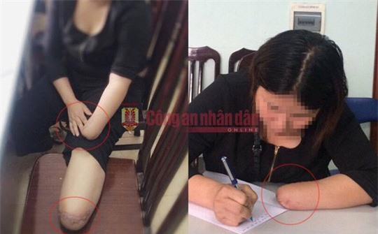 Thuê chặt chân tay để trục lợi: Tình tiết chấn động