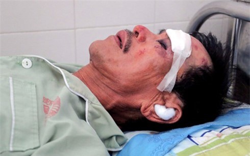 Người bị thương trong vụ rơi máy bay ở Phú Yên giờ ra sao?