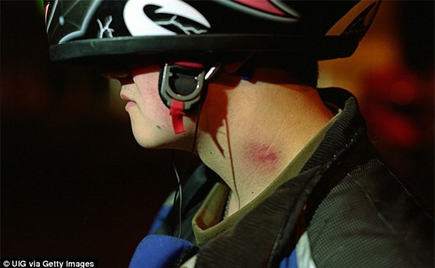 Bạn gái cắn yêu vào cổ, nam thanh niên tử vong